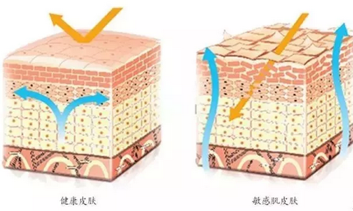 敏感肌膚與健康肌膚的對比，導(dǎo)致肌膚敏感的原因有哪些