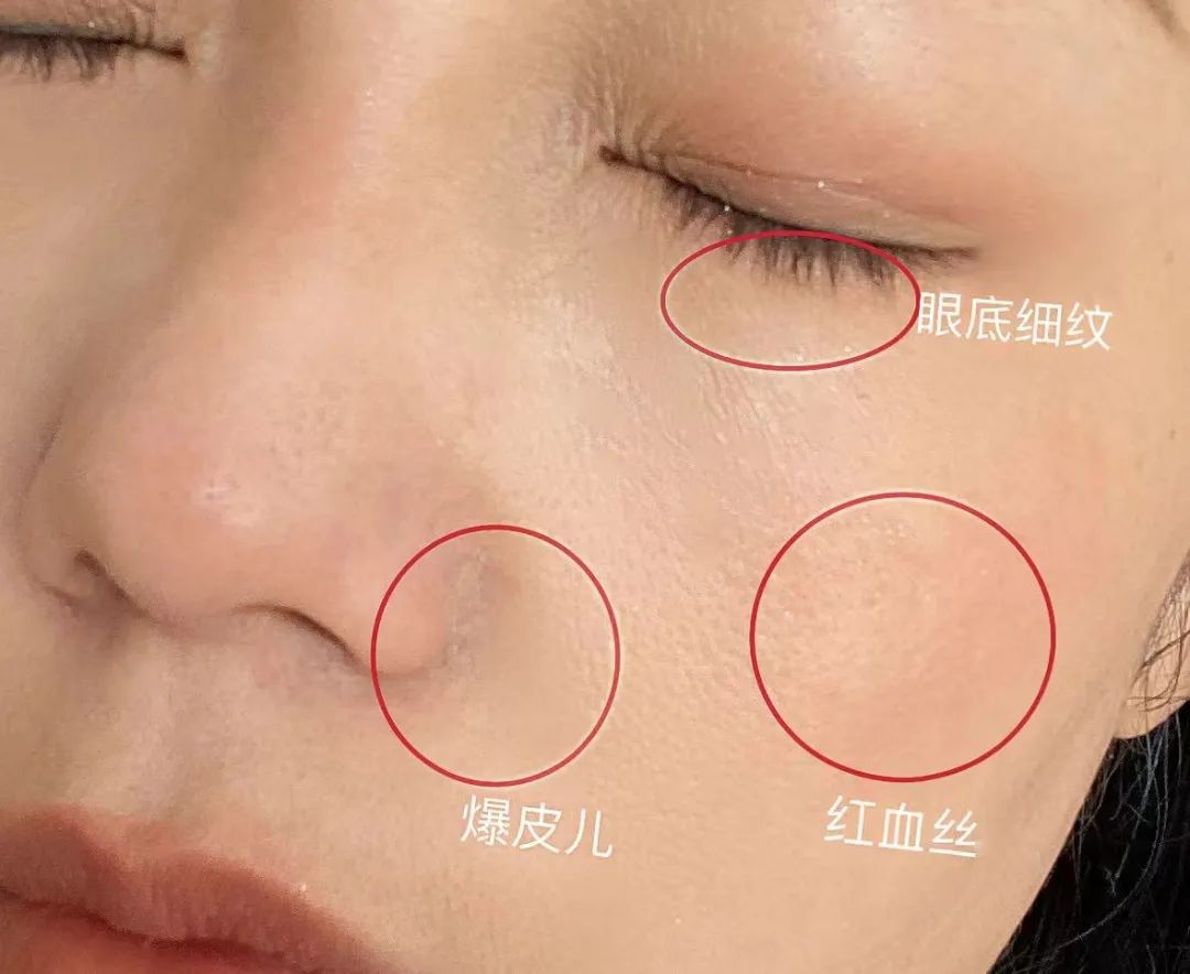 如何判斷自己是不是干敏肌膚？干敏肌有哪些特征？